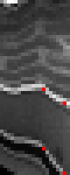 Dilating slice with red dots